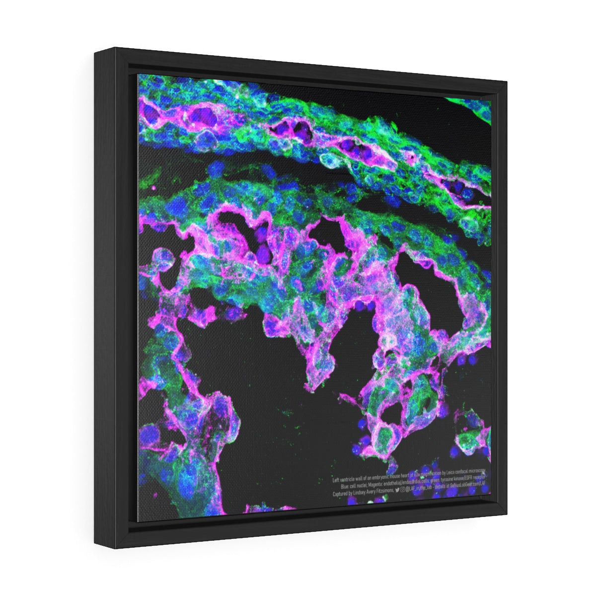 Heart science art microscopy of left ventricle, gift for scientists