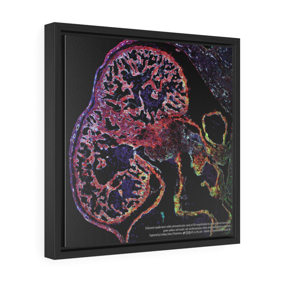 Atrioventricular canal heart microscopy canvas wall art for cardiologist office, gift for scientists